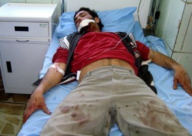 ثمانية شهداء في عملية انتحارية ضد قوات الامن في الرمادي Wonded_iraqi_man_in_suicide_explosion_1003009